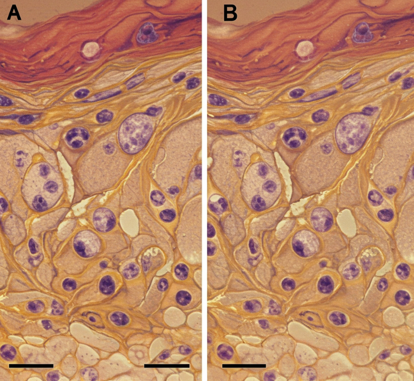 Microscopía comparativa de células tratadas con adrenocromo